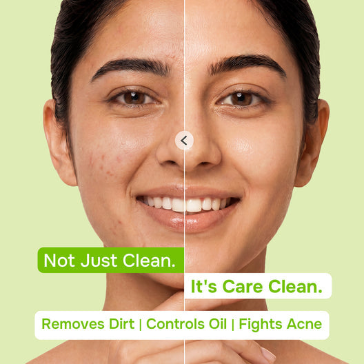 SWISS BEAUTY Care Juicy Glow Face Wash Tea Tree + Salicylic Acid